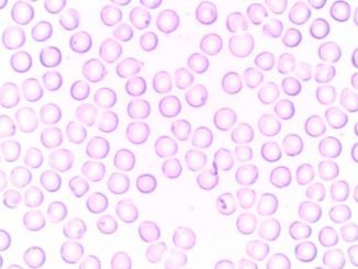 beyaz kan hücresi